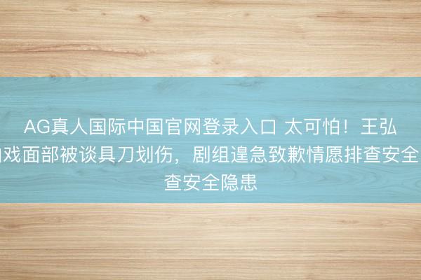 AG真人国际中国官网登录入口 太可怕！王弘毅拍戏面部被谈具刀划伤，剧组遑急致歉情愿排查安全隐患